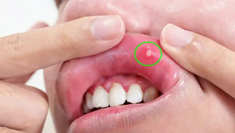 B Vitamini Eksikliği: Vücudunuza Dikkat Edin, Bu Belirtilere Bakın!