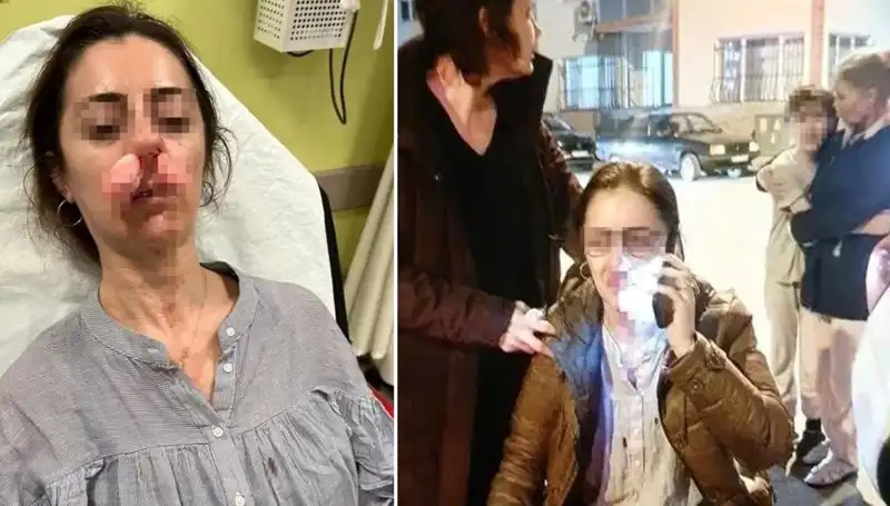 Eşinin Sevgilisini Araba Kapısıyla Vuran Koca: Silah Sayılan Olay